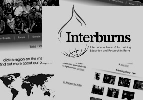 dorindesign - Interburns